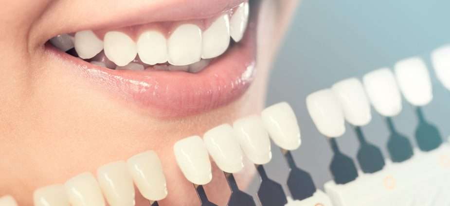 Cosmetic Dentistry Ballarat by Lydiard St Dental